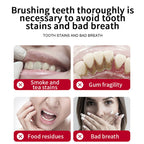 SP-8/SP-10 Probiotic Whitening Toothpaste For Oral Health