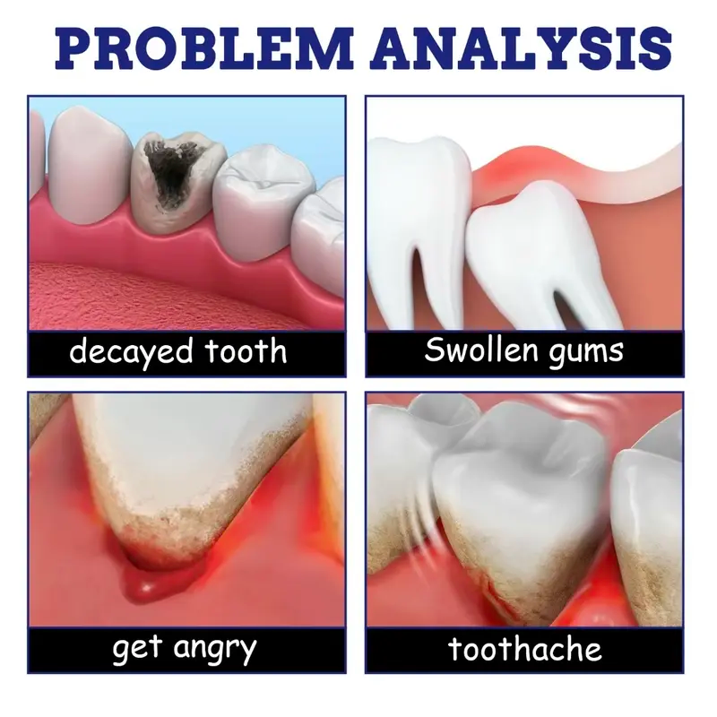 Special Analgesic Spray For Toothache
