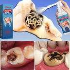 Special Analgesic Spray For Toothache