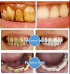 7.5% Nano Hydroxyapattite Toothpact